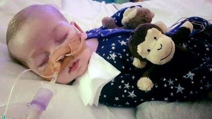 Charlie Gard padece una enfermedad genética que le impiden las funciones básicas para vivir