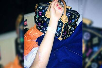 Charlotte, ¿adicta a las cirugías?