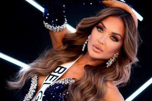 Chayenne van Aarle habló sobre su salud tras el peligroso accidente que sufrió (Foto Instagram @chayennevanaarle)