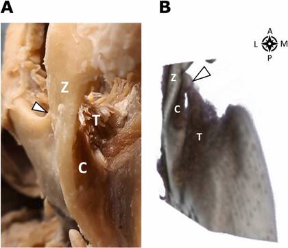 Científicos descubrieron una nueva parte del cuerpo humano
