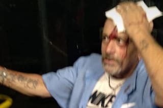 Golpearon brutalmente a un colectivero durante un robo y hay tres líneas de paro