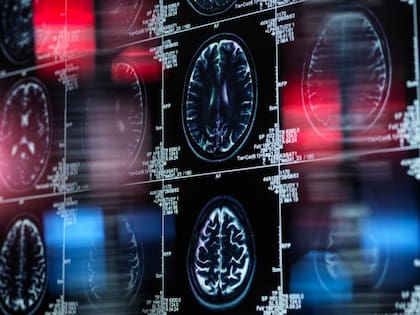 ¿Cómo afecta la enfermedad a la función del cerebro y a nuestro estado mental?