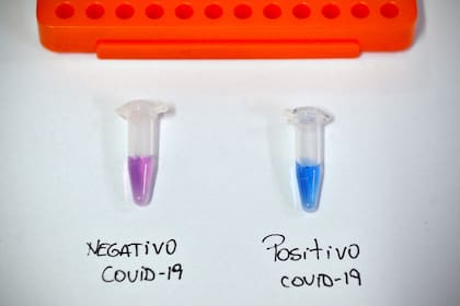 Una vez tomada la muestra, se coloca en una solución, que si se torna lila el resultado es negativo, y si es celeste se trata de un caso de Covid-19 positivo