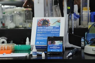 Coronavirus en la Argentina: cómo es el test de diagnóstico creado en el país