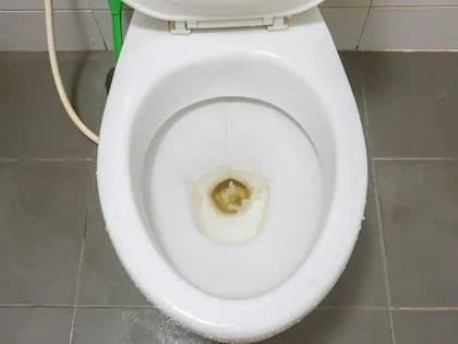 Cómo la gelatina puede contribuir a que el sarro desaparezca del inodoro