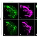 Una inteligencia artificial permite ver cómo una enfermedad altera todo el cuerpo, célula por célula