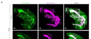 Una inteligencia artificial permite ver cómo una enfermedad altera todo el cuerpo, célula por célula