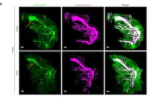 Una inteligencia artificial permite ver cómo una enfermedad altera todo el cuerpo, célula por célula