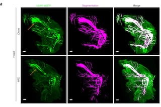 Una inteligencia artificial permite ver cómo una enfermedad altera todo el cuerpo, célula por célula