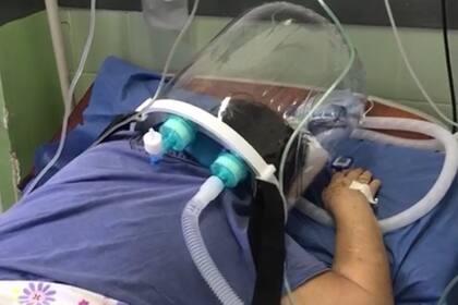 Con la istración de oxígeno, los pacientes se colocan boca abajo para mejorar la oxigenación en sangre