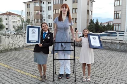 Con sus 215,16 centímetros de altura, Rumeysa Gelgi, que padece el síndrome de Weaver-Smith fue coronada oficialmente por Guinness World Records como la mujer más alta del mundo