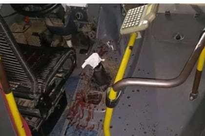 Con un machete: le cortaron un dedo a un colectivero para robarle en José C. Paz