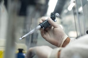 Confirmaron el primer caso en la Argentina de una variante más contagiosa y severa de la viruela símica