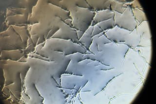 Se expanden las cepas resistentes del hongo que causa una enfermedad de la soja