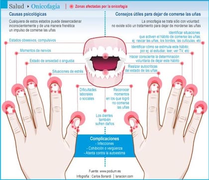 Consejos para dejar de comerse las uñas