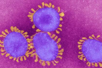 El virus del covid-19 ha sido catalogado como un virus con potencial endémico por la OMS.