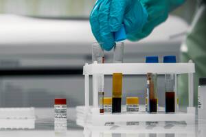 Coronavirus en Argentina: casos en San Alberto, Córdoba al 27 de septiembre