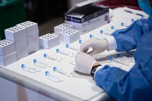 Coronavirus hoy en Venezuela: cuántos casos se registran al 26 de Abril