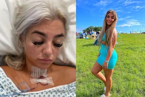 Courtney Nettleton, ciudadana de Reino Unido que tiene 20 años, comenzó a presentar signos “incontrolables” de cansancio extremo.