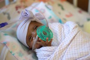 Nació la bebé más prematura del mundo: pesa lo mismo que una manzana