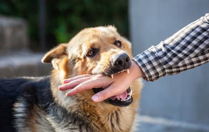 Cuál es la recomendación de los especialistas si tu perro muerde tu mano o brazo