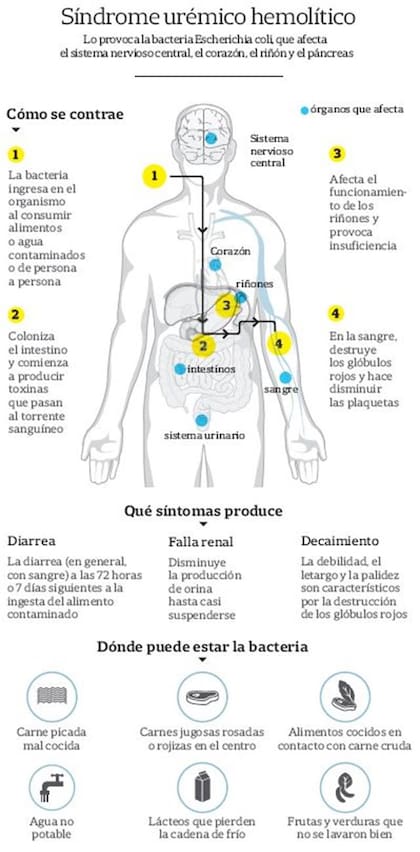 Cuáles son los efectos del Síndrome Urémico Hemolítico y cómo se contrae