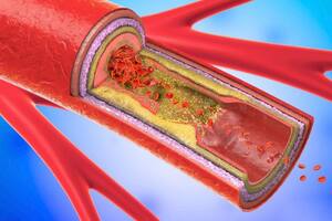 Colesterol: la biomolécula que nadie quiere en su cuerpo y sin la cual estaríamos muertos