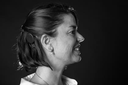 Cuando estaba en la universidad, Carolina perdió el poco resto auditivo que tenía y tuvieron que hacerle un implante coclear