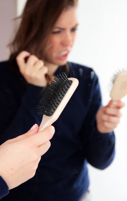 Cuando las reservas de hierro se agotan, puede que el cabello se caiga más. Crédito: Mascha Brichta / dpa-tmn