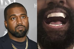 Cuántos miles de dólares gastó Kanye West en su nueva dentadura de titanio