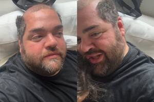 Darío Barassi mostró la reacción que tuvo su hija cuando lo vio con la cabeza pelada