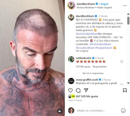 David Beckham y su pequeño hueco en el cuero cabelludo que despertó risas en su esposa