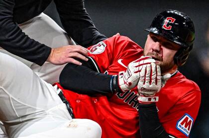 El jugador cayó al suelo ensangrentado, mientras el mánager Stephen Vogt y el personal médico ingresaban de al terreno