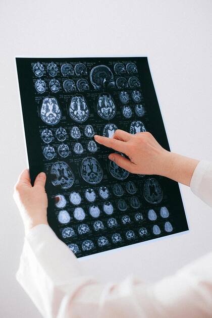 De acuerdo a ciertos estudios, se identificó que ciertos alimentos naturales pueden influir en una reducción de grasas saturadas y por ende, prevenir de la aparición de demencia