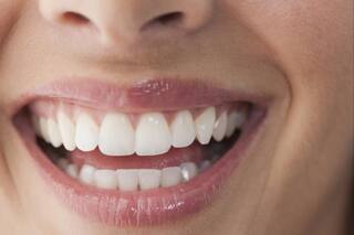 Dientes amarillos: el ingrediente casero que permite blanquear la dentadura