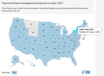 De acuerdo con los Centros para el Control y Prevención de Enfermedades, Nueva York es hasta este lunes el estado con más casos de viruela del mono en el país
