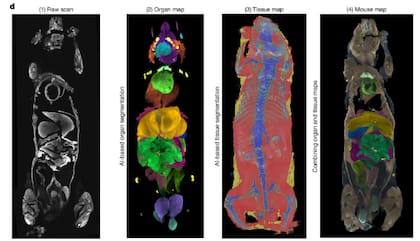 De izquierda a derecha, el sistema reconstruye el cuerpo completo a partir de imágenes crudas y aplica inteligencia artificial para identificar órganos, tejidos y generar un mapa anatómico integrado