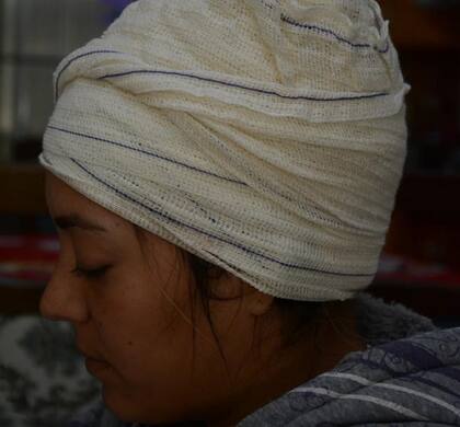 De los cinco disparos que recibió Micheli Schlosser, dos rozaron su cabeza