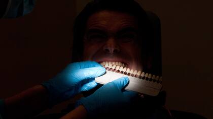 ¿De qué color son los dientes ahora y de qué color podrían llegar a ser? Con el bleaching se puede reducir el tono hasta tres niveles. Crédito: Klaus-Dietmar Gabbert / dpa-tmn