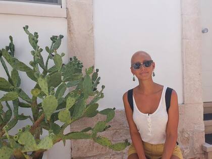 Denise Cirone tardó cinco años en empezar a salir sin peluca