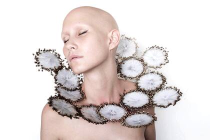 Denise vive en Italia y está por lanzar una campaña para generar conciencia