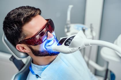 El blancamiento dental profesional consiste en colocar una barrera gingival que protege las encías, lengua y paladar y después se aplica un gel blanqueante que se activa mediante luz LED