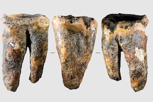 Descubren un diente de hace 59.000 años con tratamientos para las caries