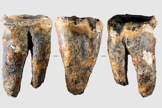 Descubren un diente de hace 59.000 años con tratamientos para las caries