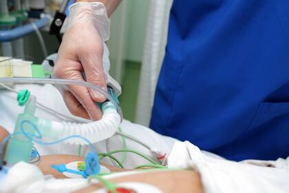 Dependiendo de la gravedad del caso, se puede administrar oxígeno mediante una intubación o bigotera