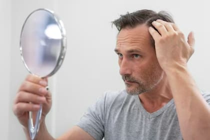 Dermatólogos de Cleveland Clinic señalan que el extracto puede ayudar en casos de caída reciente, pero no ofrece resultados garantizados