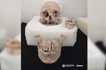 Detalle de los dientes con caries en los restos mayas