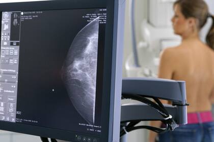 Determinados tipo de cáncer de mama pueden tratarse con un nuevo medicamento, que logró duplicar la sobrevida en pacientes estudiadas