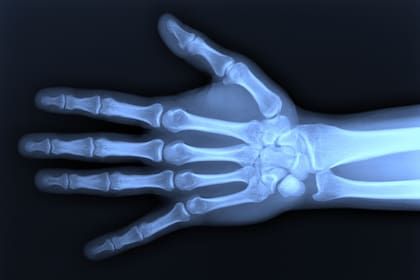 Dicen que se puede percibir el choque de los huesos entre ellos