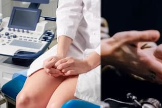 Diseñan un nuevo espéculo vaginal que promete hacer menos incómodos los exámenes ginecológicos